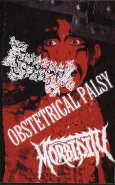 FUNERAL SPEECH / OBSTETRICAL PALSY / MORBIDITY - 3 Way Split