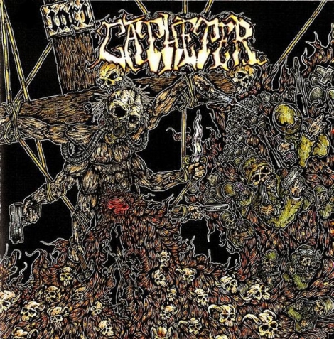 Catheter - INRI (Vinyl EP)