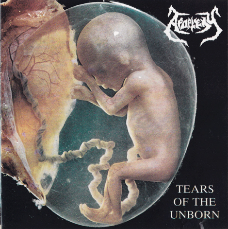 Apoplexy - Tears Of The Unborn / Dysmorphophobia (CD)