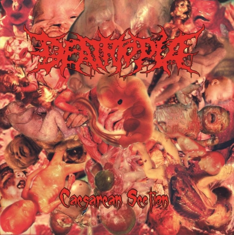 Deathtopia - Caesarean Section (LP)