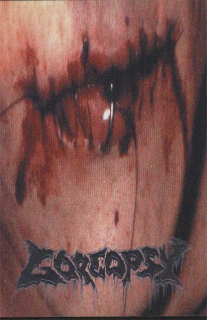 Goreopsy: Intentional Disfiguration (MC)