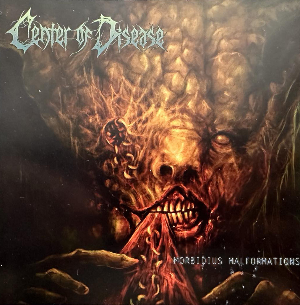 Center Of Disease: Morbidius Malformations (CD)
