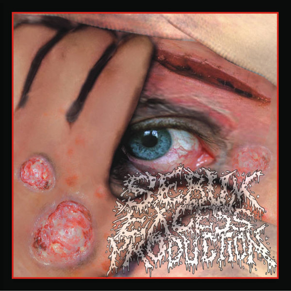 Anus Tumor / Sebum Excess Production / Cannibe: 3 Way CD (CD)