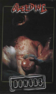 Bleeding: Donors (MC)