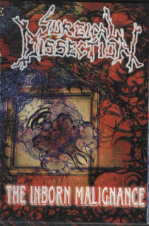 Surgical Dissection: The Inborn Malignance (MC)