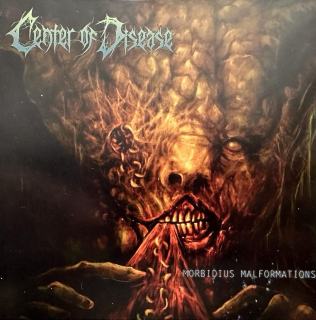 Center Of Disease: Morbidius Malformations (CD)