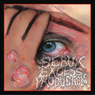 Anus Tumor / Sebum Excess Production / Cannibe: 3 Way CD (CD)